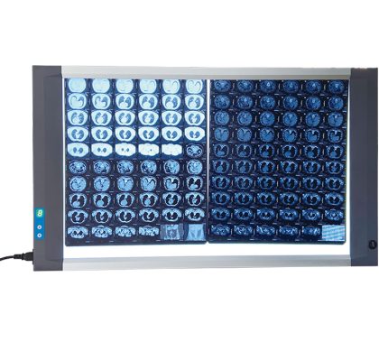 X-Ray Viewer XRV-01-2